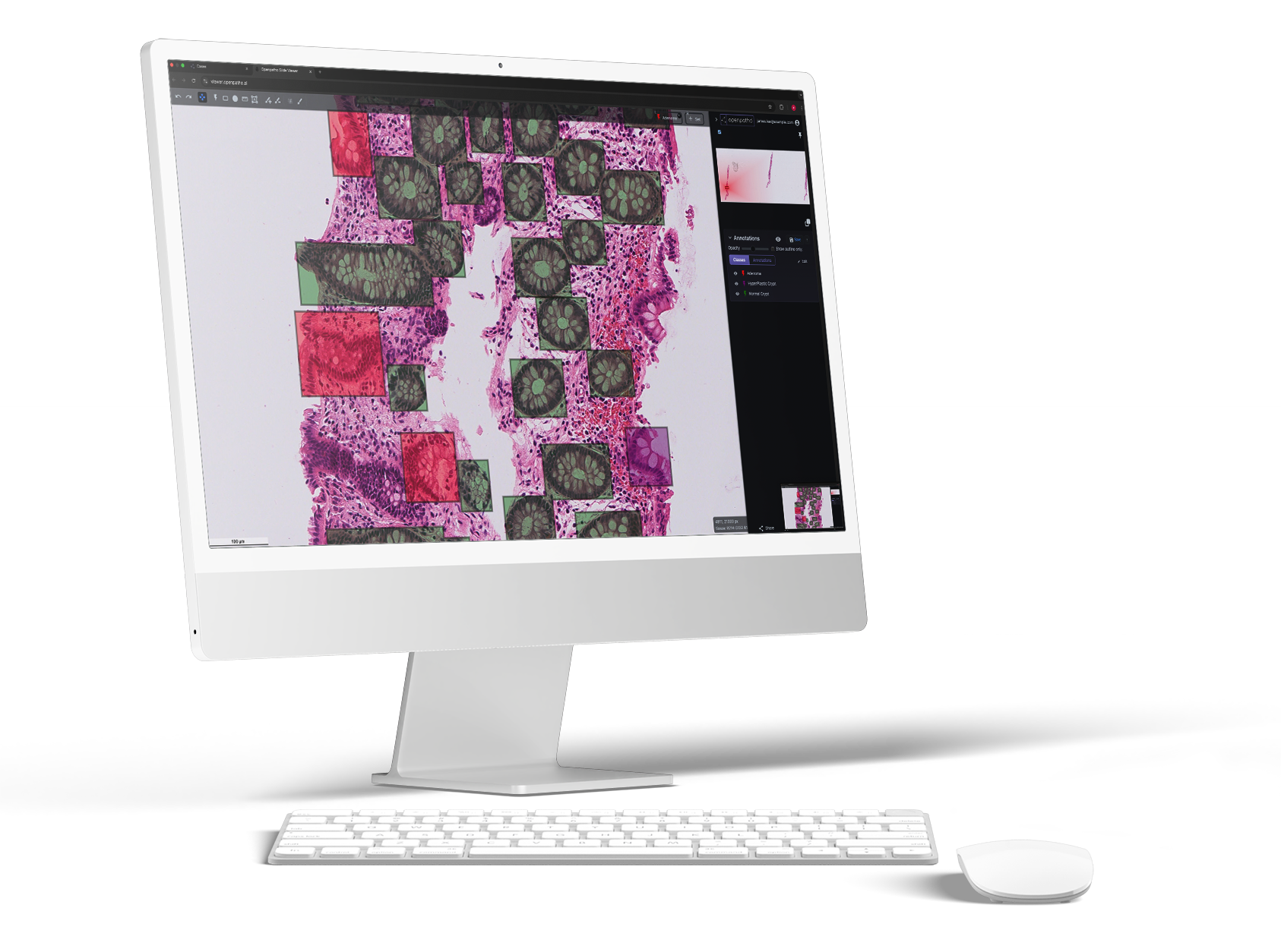 Openpatho-single-desktop-mock-up